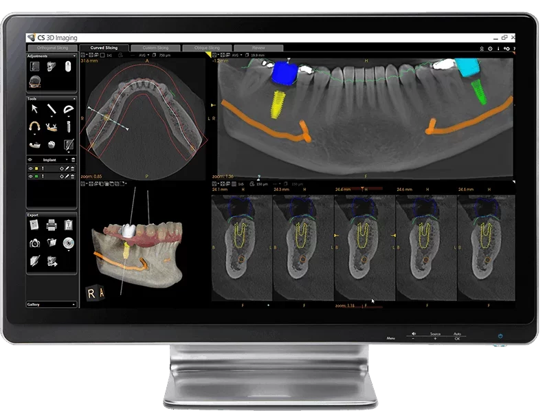 monitor-pdipplanningmarks-800x601