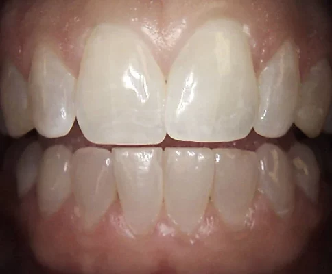 1500-001rgbfront-771x637