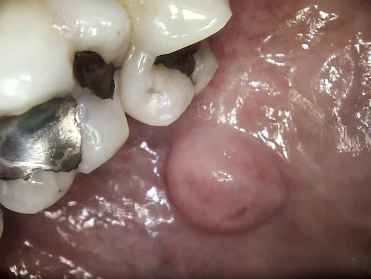 1500-002rgbsalivaduct-1024x768