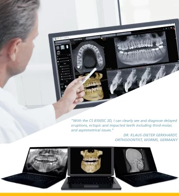cs-8100-shot-eng-1-1015x1111